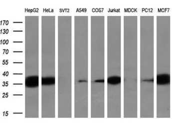 Anti-Sorbitol Dehydrogenase antibody [1D5] used in Western Blot (WB). GTX83588