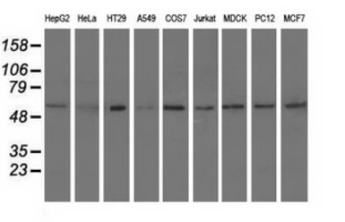 Anti-Syntrophin alpha 1 antibody [1H10] used in Western Blot (WB). GTX83607