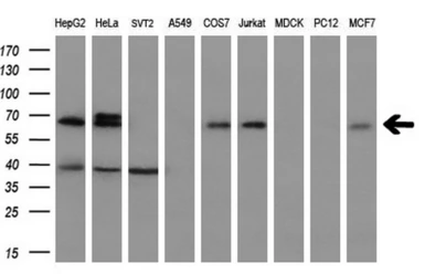 Anti-SLC7A8 antibody [5A9] used in Western Blot (WB). GTX83618