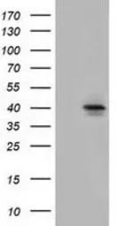 Anti-SLC30A3 antibody [2H6] used in Western Blot (WB). GTX83623