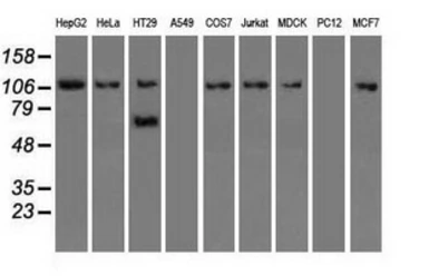 Anti-SIGLEC9 antibody [8F7] used in Western Blot (WB). GTX83647