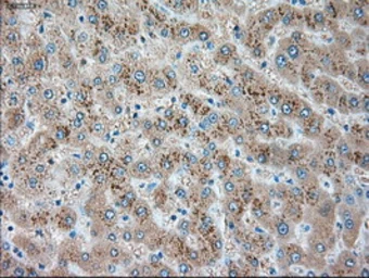 Anti-alpha 1 Antitrypsin antibody [11G2] used in IHC (Paraffin sections) (IHC-P). GTX83663