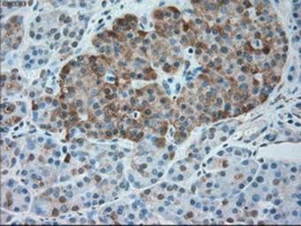 Anti-alpha 1 Antitrypsin antibody [11G2] used in IHC (Paraffin sections) (IHC-P). GTX83663