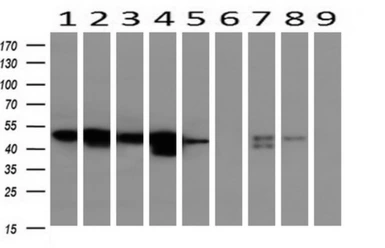 Anti-alpha 1 Antitrypsin antibody [11G2] used in Western Blot (WB). GTX83663