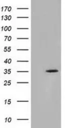 Anti-SDR9C7 antibody [4B5] used in Western Blot (WB). GTX83671