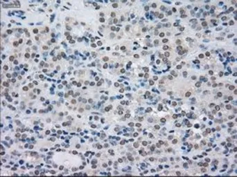 Anti-SATB1 antibody [13D6] used in IHC (Paraffin sections) (IHC-P). GTX83682