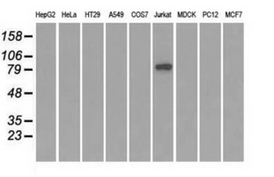 Anti-SATB1 antibody [6C6] used in Western Blot (WB). GTX83685