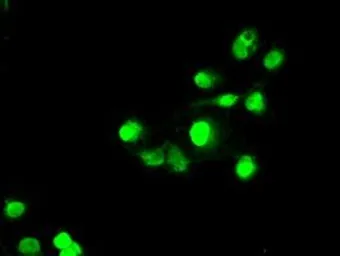 Anti-SATB1 antibody [6C6] used in Immunocytochemistry/ Immunofluorescence (ICC/IF). GTX83685