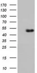 Anti-Ribonuclease Inhibitor antibody [3F11] used in Western Blot (WB). GTX83696