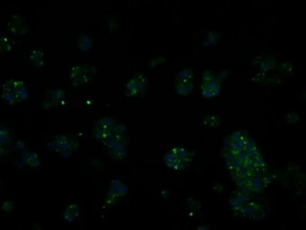 Anti-RIC8A antibody [3G3] used in Immunocytochemistry/ Immunofluorescence (ICC/IF). GTX83714