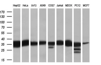 Anti-RDH11 antibody [1B4] used in Western Blot (WB). GTX83716