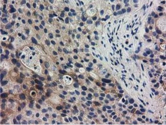 Anti-RASD2 antibody [1G1] used in IHC (Paraffin sections) (IHC-P). GTX83722