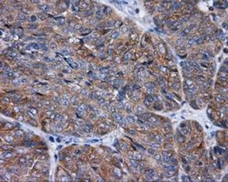 Anti-RALBP1 antibody [2A6] used in IHC (Paraffin sections) (IHC-P). GTX83734