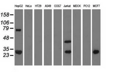 Anti-QPRT antibody [4B4] used in Western Blot (WB). GTX83744