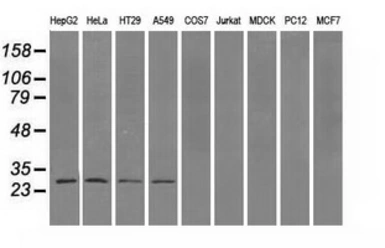 Anti-PSMA7 antibody [2A7] used in Western Blot (WB). GTX83786