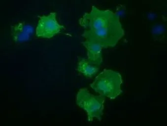 Anti-PKD2 antibody [3B12] used in Immunocytochemistry/ Immunofluorescence (ICC/IF). GTX83819