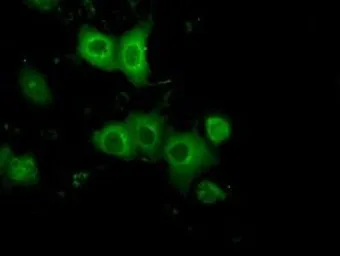 Anti-PKA R2 antibody [4A3] used in Immunocytochemistry/ Immunofluorescence (ICC/IF). GTX83825