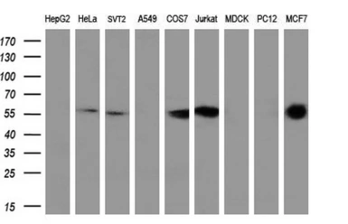 Anti-PPP5C antibody [3G1] used in Western Blot (WB). GTX83836