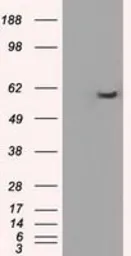 Anti-PPP5C antibody [3G1] used in Western Blot (WB). GTX83836
