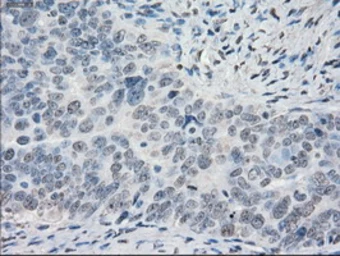 Anti-POR antibody [1B11] used in IHC (Paraffin sections) (IHC-P). GTX83858
