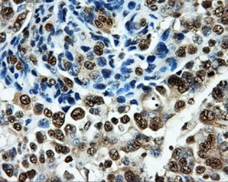 Anti-PKMYT1 antibody [5E1] used in IHC (Paraffin sections) (IHC-P). GTX83877
