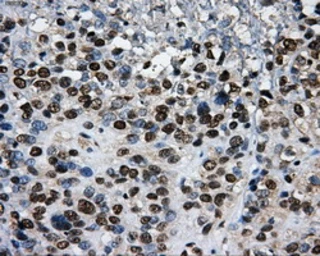 Anti-PKMYT1 antibody [5E1] used in IHC (Paraffin sections) (IHC-P). GTX83877