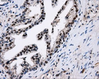 Anti-PKMYT1 antibody [5E1] used in IHC (Paraffin sections) (IHC-P). GTX83877