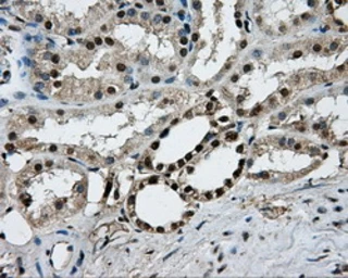 Anti-PKMYT1 antibody [5E1] used in IHC (Paraffin sections) (IHC-P). GTX83877