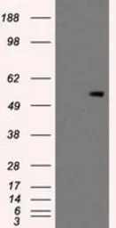 Anti-PKMYT1 antibody [5E1] used in Western Blot (WB). GTX83877
