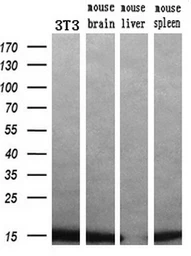 Anti-Profilin 1 antibody [1D5] used in Western Blot (WB). GTX83903
