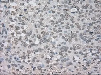 Anti-TrkC antibody [4E10] used in IHC (Paraffin sections) (IHC-P). GTX83977