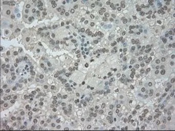 Anti-TrkC antibody [4E10] used in IHC (Paraffin sections) (IHC-P). GTX83977