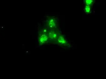 Anti-TrkC antibody [4E10] used in Immunocytochemistry/ Immunofluorescence (ICC/IF). GTX83977