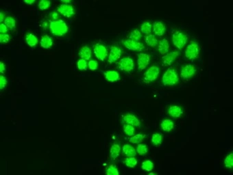 Anti-TrkC antibody [4E10] used in Immunocytochemistry/ Immunofluorescence (ICC/IF). GTX83977