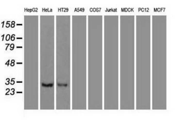 Anti-Neurotrophin 3 antibody [3D4] used in Western Blot (WB). GTX83984