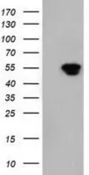 Anti-NT5DC1 antibody [3H2] used in Western Blot (WB). GTX83991