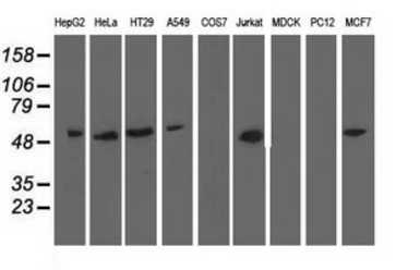 Anti-NT5DC1 antibody [3H2] used in Western Blot (WB). GTX83991