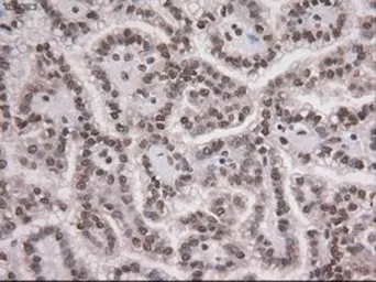 Anti-NOTCH1 antibody [4C9] used in IHC (Paraffin sections) (IHC-P). GTX84020