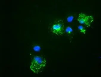 Anti-Noggin antibody [4C12] used in Immunocytochemistry/ Immunofluorescence (ICC/IF). GTX84023