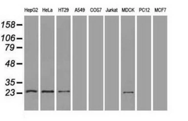 Anti-Neurogenin 1 antibody [8G8] used in Western Blot (WB). GTX84047