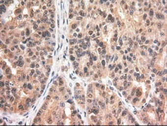 Anti-c-Myc antibody [1A6] used in IHC (Paraffin sections) (IHC-P). GTX84066