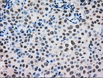 Anti-MRI1 antibody [9H7] used in IHC (Paraffin sections) (IHC-P). GTX84085