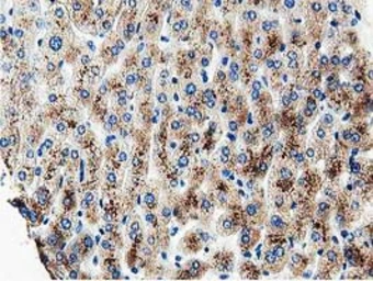 Anti-MOB1B antibody [1H2] used in IHC (Paraffin sections) (IHC-P). GTX84105