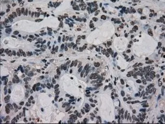 Anti-Ki67 antibody [3D11] used in IHC (Paraffin sections) (IHC-P). GTX84107