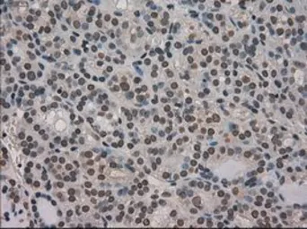 Anti-Ki67 antibody [3D11] used in IHC (Paraffin sections) (IHC-P). GTX84107