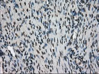Anti-Ki67 antibody [3D11] used in IHC (Paraffin sections) (IHC-P). GTX84107