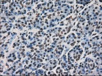 Anti-Ki67 antibody [3D11] used in IHC (Paraffin sections) (IHC-P). GTX84107
