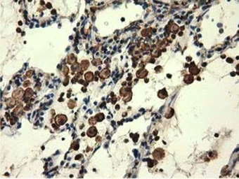 Anti-MICAL1 antibody [2H1] used in IHC (Paraffin sections) (IHC-P). GTX84125