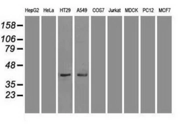 Anti-JNK1 antibody [1C2] used in Western Blot (WB). GTX84143
