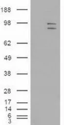 Anti-ERK3 antibody [5E1] used in Western Blot (WB). GTX84146